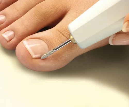 PETER BAUSCH ▫️ 0319D - Conjunto de manicure e pedicure (inclui suporte acrílico e dispositivo de tensão) 6