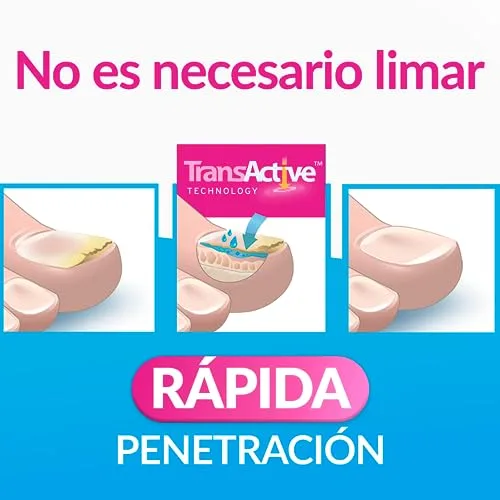 Excilor ▫️ Tratamento da micose das unhas, Solução, Devolve a saúde e a beleza às unhas infetadas, Penetração rápida, Fácil aplicação com pincel, Clinicamente testado, 3,3 ml 4