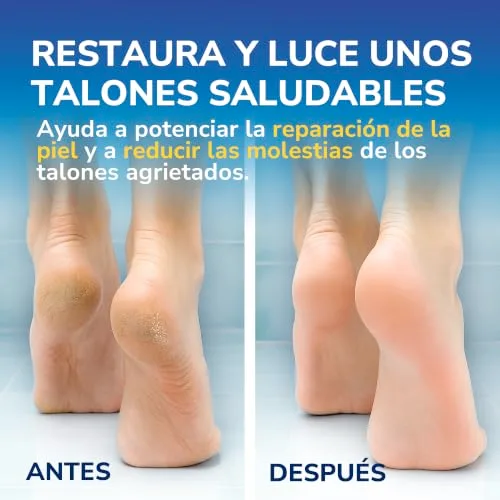 Dr. Scholl's ▫️ Scholl Creme para os Pés para Calcanhares Gretados, com Ureia e Queratina, Branco, 60 Mililitros, 6 4