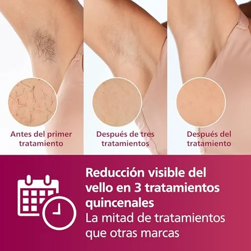 PHILIPS ▫️ Lumea série 7000, aparelho de depilação IPL, alternativa à depilação a laser, 3 acessórios para o corpo, o rosto e a zona do biquíni, modelo SC1999/00 3