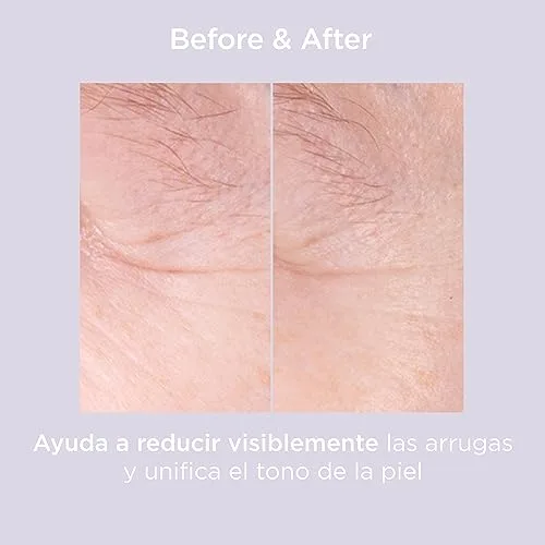 ISDIN ▫️ Isdinceutics Glicoisdin 25 Gel Esfoliante com Ácido Glicólico, Ação Esfoliante para uma Pele Renovada, 25 g 2