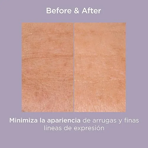 ISDIN ▫️ Isdinceutics Glicoisdin 25 Gel Esfoliante com Ácido Glicólico, Ação Esfoliante para uma Pele Renovada, 25 g 3