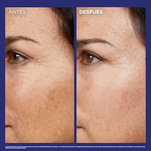L'Oreal Paris ▫️ L'Oréal Paris Revitalift Laser Sérum de Noite N.º 1 com Retinol Puro, 30 ml 6