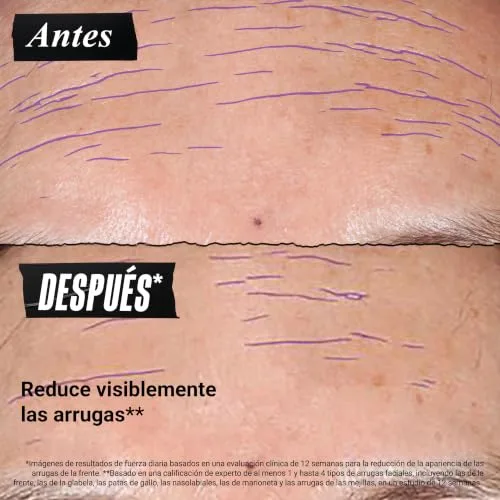 Kiehl's ▫️ Retinol Skin-Renewing Daily Micro-Dose Treatment, sérum antienvelhecimento reafirmante para uma pele uniforme e jovem, suaviza as rugas e refina a textura da pele 7