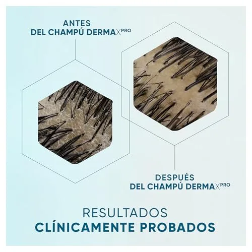 Procter & Gamble ▫️ H&S DermaXPro Champô Calmante Anticaspa para Comichão no Couro Cabeludo 6x300 ml 3