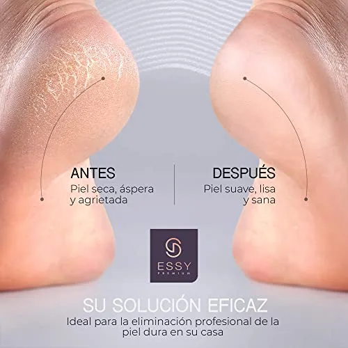 Essy ▫️ Lima Aparelho Elétrico para os Pés com 5 Rolos de Recambio (Roxo) 5