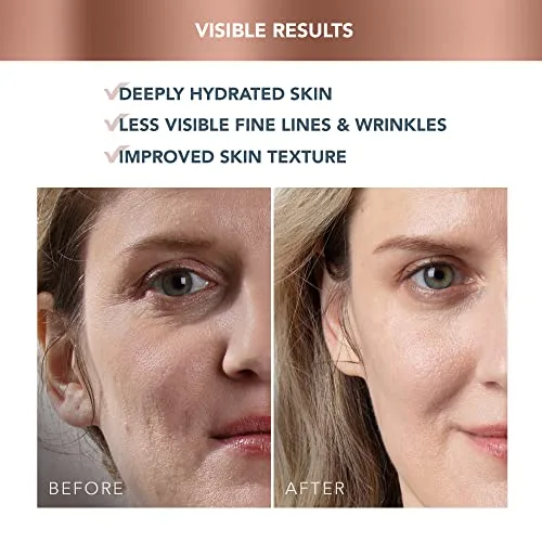FOREO ▫️ SUPERCHARGED Creme Hidratante Facial de Tripla Ação HA+PGA - Creme Hidratante Facial para Mulher - Contorno dos Olhos - Ácido Hialurónico - Vitamina E - Vegano - Creme Facial para Homem - Cuidados da Pele - 50 ml 4