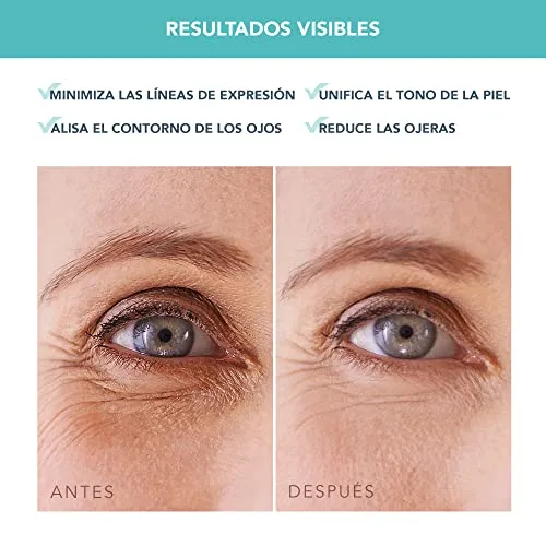 FOREO ▫️ IRIS Patches para os Olhos com Colagénio - Contorno dos Olhos Anti-olheiras - Vitamina B, Vitamina C e Vitamina E - Retinol - Anti-olheiras para Mulheres - Hidratante - Vegano - 60 Patches para os Olhos para Bolsas e Olheiras 5