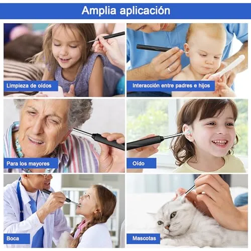 EBUYFIRE ▫️ Kit sem fios para limpeza dos ouvidos, limpador de ouvidos com otoscópio com câmara HD, carregamento por USB, kit de limpeza visual dos ouvidos com 6 LED para cuidados em família 7