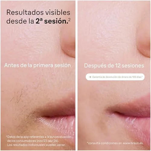 Braun ▫️ Depiladora a luz pulsada Silk-expert Pro 5, PL5140, Branca/Dourada 3