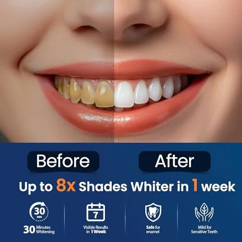Celakeety ▫️ tiras branqueadoras para os dentes - branqueadores dentários - 28 unidades de tiras branqueadoras para os dentes - 14 tratamentos de branqueamento dentário - dentes brancos - seguro para o esmalte - refresca o hálito 4