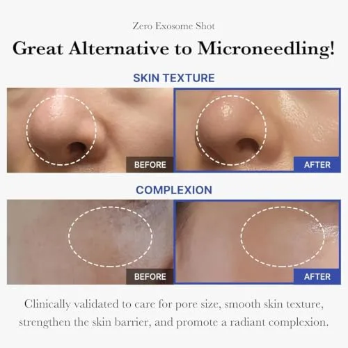 medicube ▫️ Exosome Shot Zero 2 000 PPM Soro Facial com Espículas 3