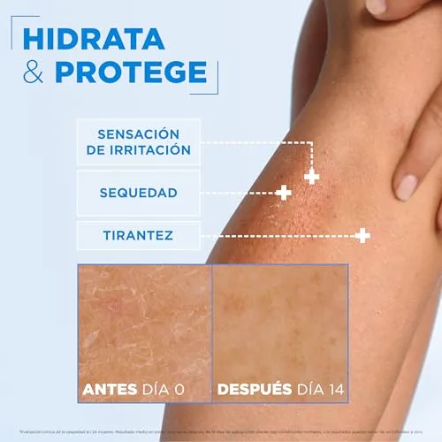 Mixa ▫️ Ceramide Protect Creme Hidratante para o Corpo para Peles Muito Secas 400 ml 5
