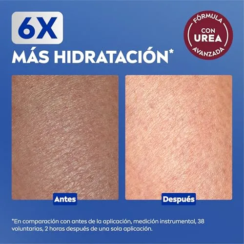 NIVEA ▫️ Repara & Cuida Creme hidratante para o corpo, rosto e mãos (1 x 400 ml), creme hidratante com glicerina e ureia, 72 horas de hidratação para pele extremamente seca e áspera 3