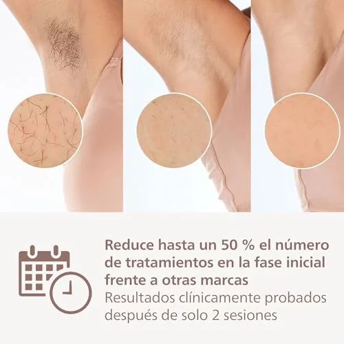 PHILIPS ▫️ Lumea série 9900, aparelho de depilação IPL, alternativa à depilação a laser, SenseIQ e SkinAI, 3 acessórios para o corpo, o rosto e zonas de precisão, com e sem fio, BRI953/02 4