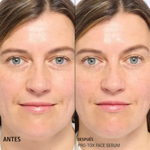 Revolution PRO ▫️ Revolution, Pro-tox, sérum facial alisante, com peptídeos para linhas finas e rugas, testado dermatologicamente, vegan e sem crueldade animal, 30 g 4