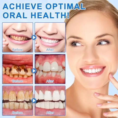 BOIUOITI ▫️ Pasta de dentes com hidroxiapatita, embalagem de 2, sem flúor. Pasta de dentes com 9,9% de nano-hidroxiapatita, protege o esmalte dentário, alivia a sensibilidade, fortalece os dentes, higiene oral 5