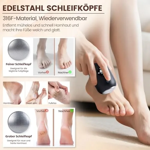 FIVAVA ▫️ Lima Elétrica para Pés com Calosidades, Kit de Pedicure Elétrico Profissional para Cuidados com os Pés, Remove Calosidades e Calos, Lima Elétrica para Pés com 2 Cabeças de Esmerilagem 316F (Preto) 4