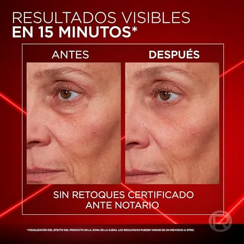 L'Oreal Paris ▫️ L'Oréal Paris Revitalift Laser - Redutor Instantâneo de Bolsas nos Olhos, 15 ml 3