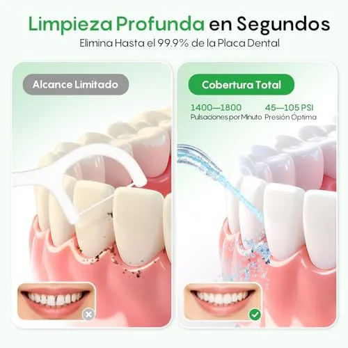 Fresko ▫️ Irrigador Dental Portátil de 300 ml Irrigador Oral 2