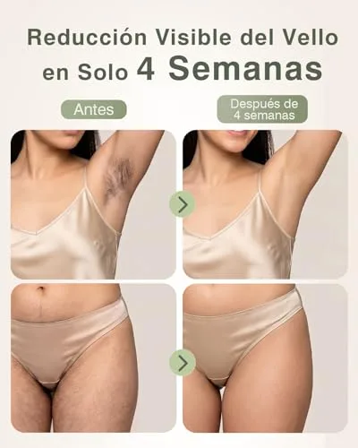 TIIMAGIC ▫️ Depiladora a laser IPL com refrigeração a 5 °C, 9 níveis de energia, 999 900 flashes, 3 funções HR/RA/SC, depilador a luz pulsada para rosto, zona do biquíni e corpo, uso doméstico ck1122 3