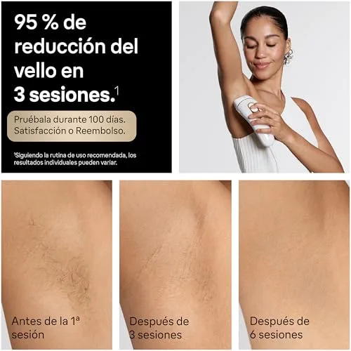 Braun ▫️ Depiladora a luz pulsada Silk·expert Pro 5, PL5321, Branco/Dourado 4