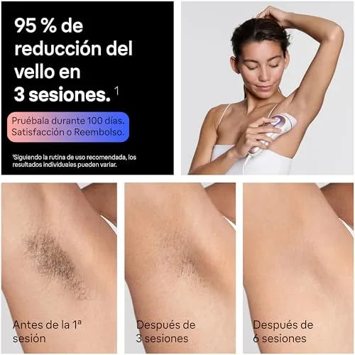 Braun ▫️ Depiladora Smart IPL Skin i·expert com luz pulsada, PL7311, Branco/Bronze 5