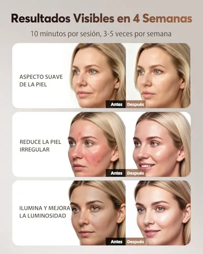 XSSNVV ▫️ Máscara facial LED com 4 modos para cuidados faciais em casa, NVV10 5
