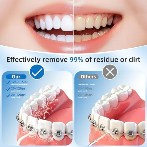 Pulsefell ▫️ Irrigador dentário portátil, irrigador a água recarregável de 300 ml 2