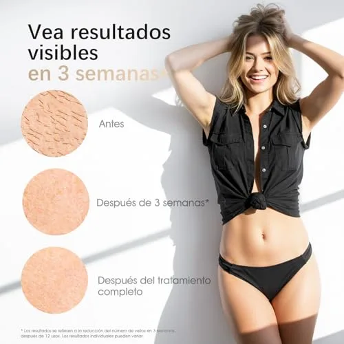 Haarlosy ▫️ Depilador a laser IPL com refrigeração para mulheres e homens, GLY07 3