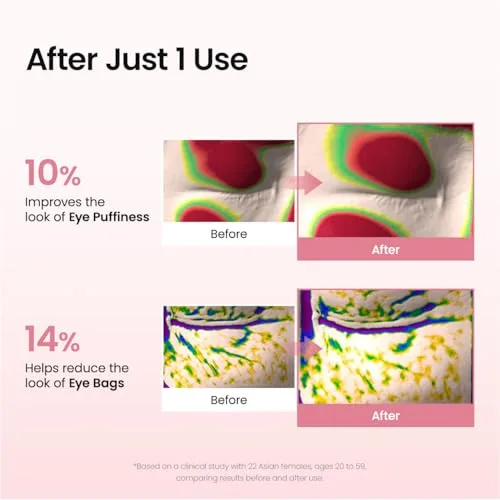 Biodance ▫️ Patches para os olhos com peptídeos de colagénio, antirranhuras para linhas de expressão e bolsas, contorno dos olhos, cuidados da pele à coreana (60 unidades) 4