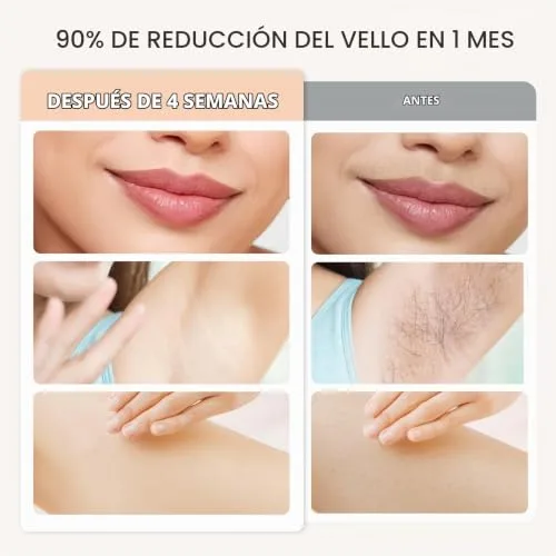 NALONE ▫️ Depilador IPL 4 em 1, Luz Pulsada para Mulheres e Homens 7