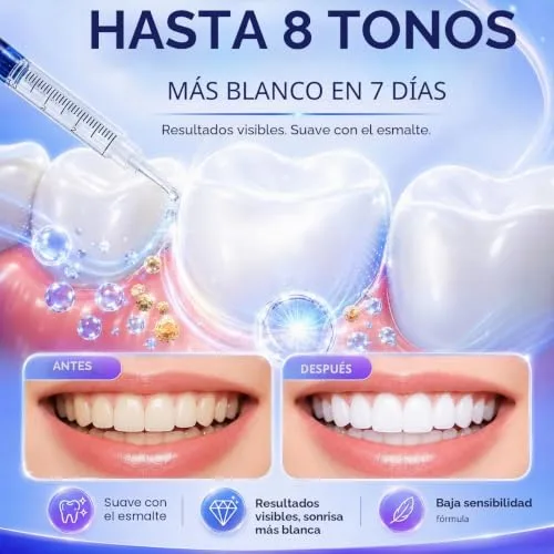LureLuxe ▫️ Branqueamento dentário em casa, Gel de branqueamento dentário, Gel de enfermagem para branqueamento dentário, Reduz manchas, Fácil aplicação, Um sorriso mais brilhante 6