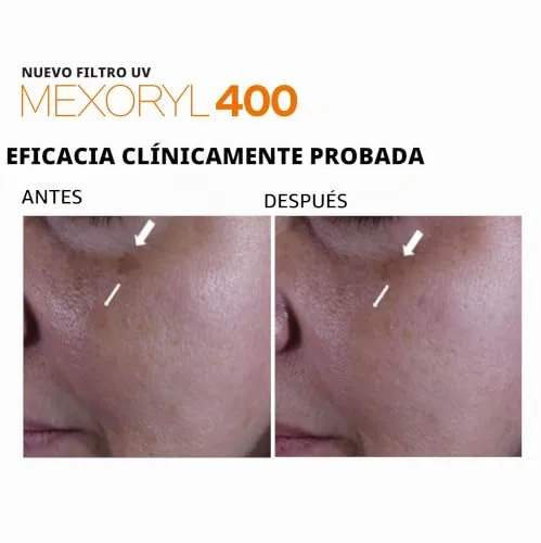 La Roche-Posay ▫️ Protetor solar, FPS 50+, previne o stress oxidativo, resistente à água, ao suor e à areia, fórmula com Mexoryl 400, fluido invisível, Anthelios UV-MUNE 400, 50 ml 3