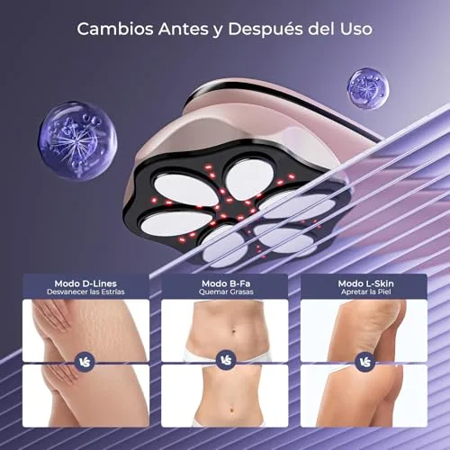 Oranmagic ▫️ Massajador anticelulítico redutor, massajador elétrico profissional para celulite, para massagem na cintura, abdómen, glúteos, braços, pernas e costas (ouro rosa) 4