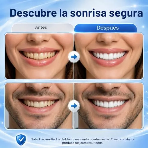CODECURE ▫️ Tiras branqueadoras para dentes sem sensibilidade, com sabor a coco, 28 tiras 4